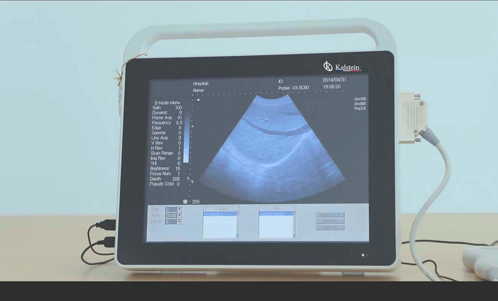 Revolutionizing Medical Imaging: The Comprehensive Guide to Kalstein's Ultrasound Scanners