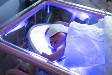 What is neonatal hyperbilirubinemia?